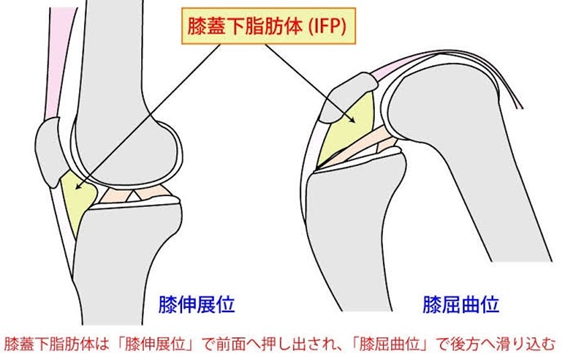 膝の前側・膝下が痛い方のためのセルフエクササイズ（膝蓋下脂肪体）①